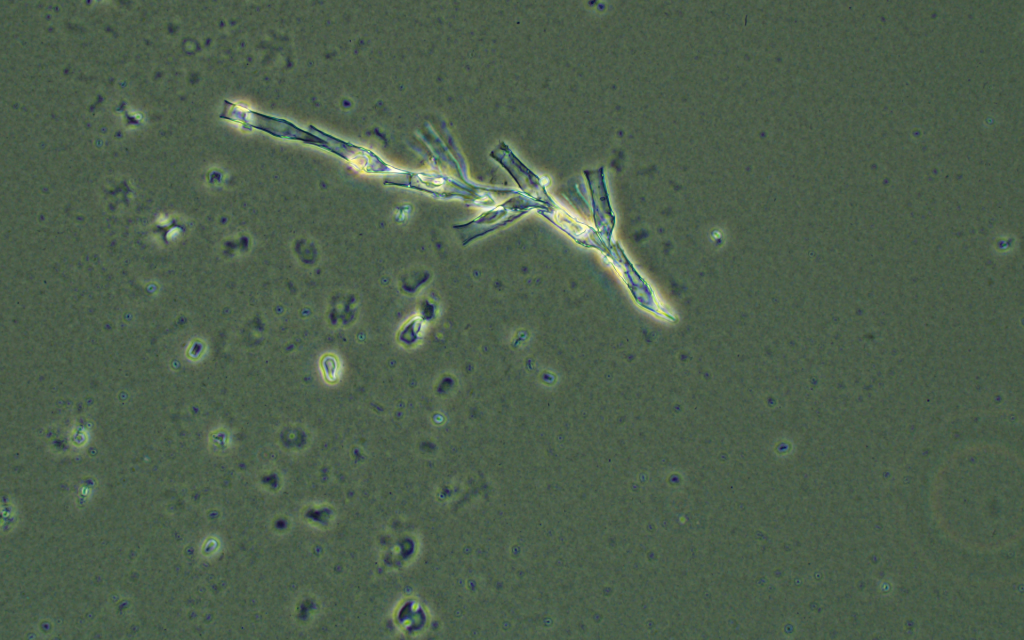 Why nutrients in water cause algae and weeds to grow The Lilly Center