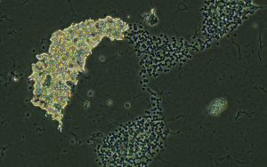 Mircocystis Under a Microscope - Lilly Center For Lakes & Streams