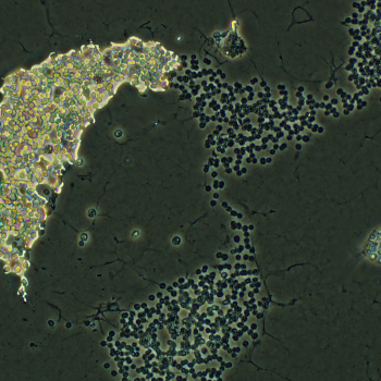 Mircocystis Under a Microscope - Lilly Center For Lakes & Streams